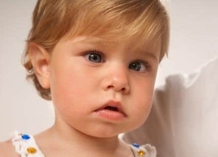 Strabismus Crossed Eyes